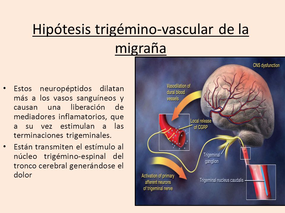 La complicación después de la operación de la enfermedad varicosa